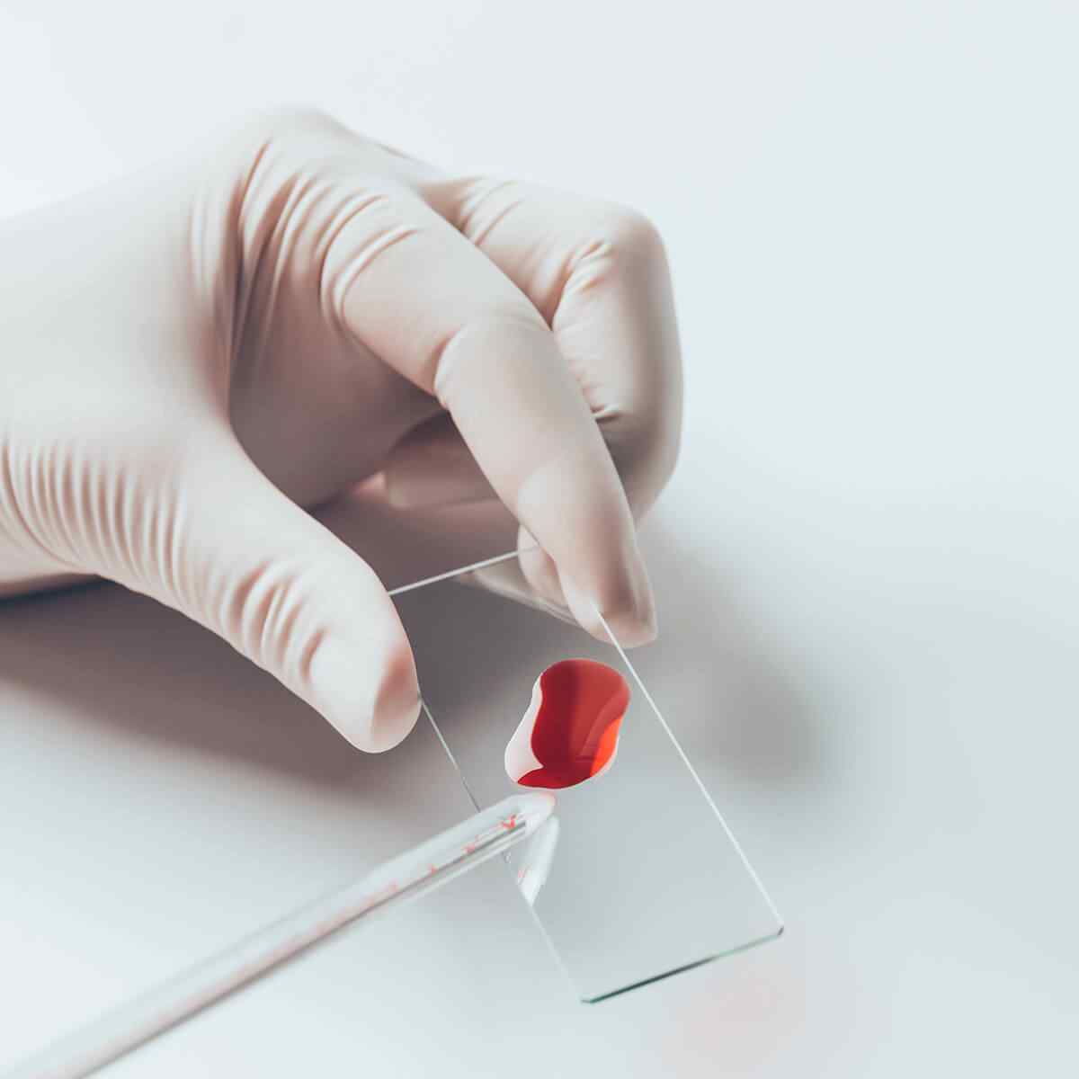 HEMATOLOGIE